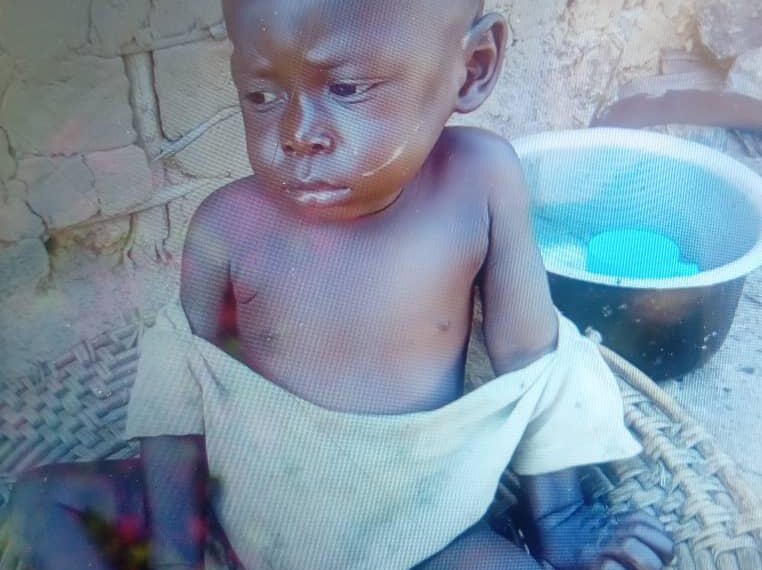 Tshopo : recrudescence des cas de malnutrition dans le territoire de Basoko, les structures sanitaires tirent la sonnette d’alarme