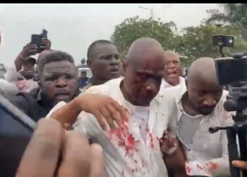Sit-in de l’opposition : Martin Fayulu blessé et évacué après de violents affrontements près du Palais du Peuple