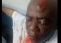 Kinshasa : Claude Mashala agressé et hospitalisé après une violente attaque nocturne