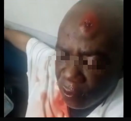 Kinshasa : Claude Mashala agressé et hospitalisé après une violente attaque nocturne