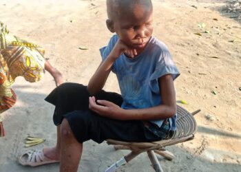 Tshopo : Basoko confronté à une inquiétante recrudescence des cas de malnutrition infantile